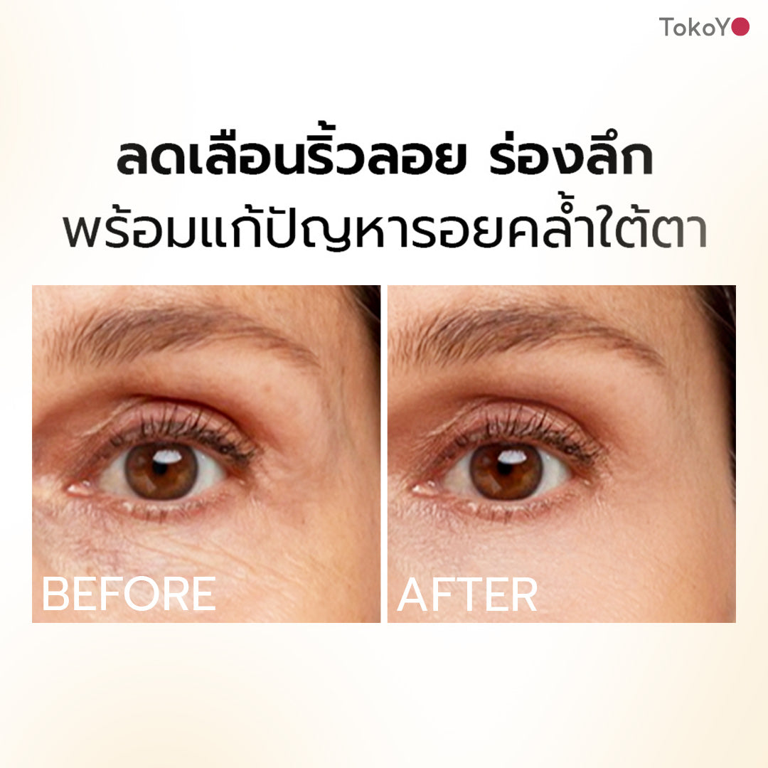 [ซื้อคู่ 2 ชิ้นถูกกว่า] MORI Retinol Ultra Firming Vibe Eye Cream | โมริ เรตินอล อัลตร้า เฟิร์มมิ่ง ไวบ์ อาย ครีม 20 g.