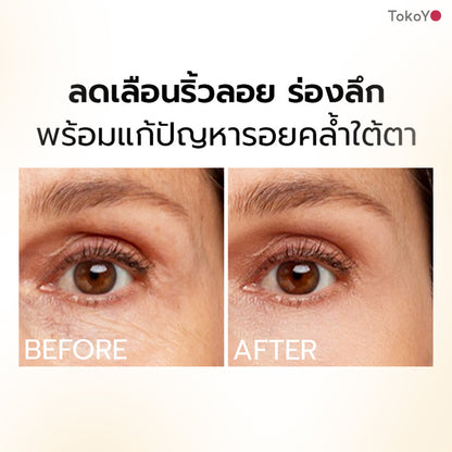 [ซื้อคู่ 2 ชิ้นถูกกว่า] MORI Retinol Ultra Firming Vibe Eye Cream | โมริ เรตินอล อัลตร้า เฟิร์มมิ่ง ไวบ์ อาย ครีม 20 g.